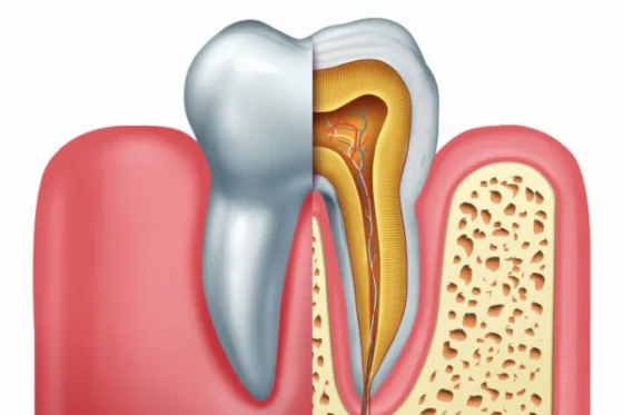 Cilj endodontske terapije je potpuna eliminacija bakterija i njihovih produkata iz unutrašnjosti zuba.