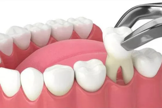 Oralna hirurgija je grana stomatologije koja se bavi hirurškim lečenjem i zbrinjavanjem tvrdih i mekih tkiva usne duplje.